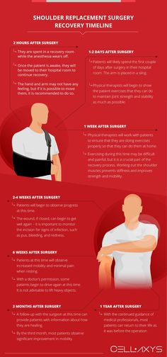 Shoulder Replacement Surgery Recovery Timeline Shoulder Replacement Surgery Recovery Tips, Reverse Shoulder Replacement Surgery, Shoulder Replacement Surgery Recovery, Post Shoulder Surgery Clothing, Shoulder Surgery Recovery Tips, Rotator Cuff Surgery Recovery, Shoulder Surgery Clothes, Reverse Shoulder Replacement, Shoulder Surgery Recovery