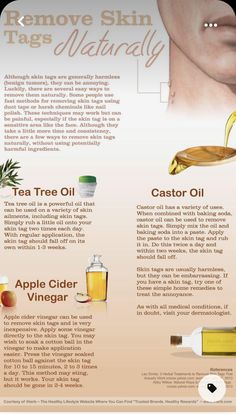 Apple Cider Vinegar For Skin, Skin Moles, Cold Sores Remedies, Natural Cold Remedies, Natural Cough Remedies