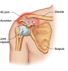 an image of the anatomy of the shoulder