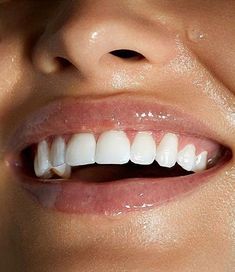 Whiten Teeth Fast, Teeth Aesthetic, Peroxide Teeth Whitening, Pretty Teeth, Beautiful Teeth, Teeth Whitening Gel, Straight Teeth, Perfect Teeth, Nice Teeth