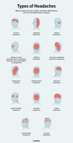 Headache Types, Migraine Headaches, Medical Knowledge, Health Info, Health And Beauty Tips, Health Facts, Home Health, Useful Life Hacks, Massage Therapy