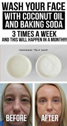 Coconut Oil Face Wash, Baking Soda Face Wash, Oil Face Wash, Coconut Oil And Baking Soda, Baking Soda Face, Coconut Oil For Face, Baking Soda Uses, Coconut Oil For Skin