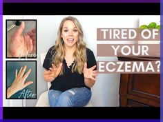 You’re dedicated to your family, your home, and your job and pride yourself on giving your best to it all, but lately you feel exhausted, are more easily Skin Rash On Face, Rash On Face, Best Lotion, Sensitive Skin Care, Baby Skin Care, Daily Skin Care Routine, Vegan Skincare