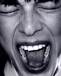 a close up of a person with his mouth open and teeth missing from tooth decay