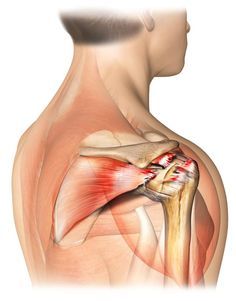 The 4 Signs of a Torn Rotator Cuff: A rotator cuff tear is an injury to the tendons of the shoulder joint. Torn Rotator Cuff Symptoms, Torn Rotator Cuff, Bursitis Shoulder, Rotator Cuff Pain, Rotator Cuff Surgery, Rotator Cuff Tear