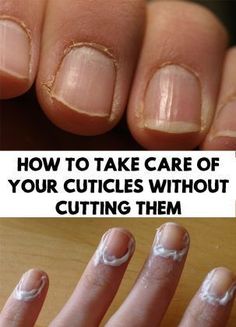 Nail Growth Tips, Grow Nails Faster, Natural Nail Care, Cuticle Care, How To Grow Nails, Brittle Nails, Care Care, Beauty Tips For Face