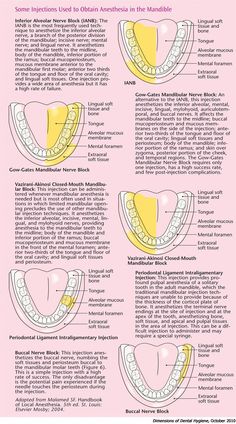 Anatomy Dental, Local Anesthesia