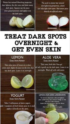 Dark Spots Remedies, Fresh Aloe Vera Gel, Black Heads, Brown Spots Removal, Resep Diet, Skin Spots, Beauty Tips For Glowing Skin, Baking Soda Shampoo, Cold Remedies