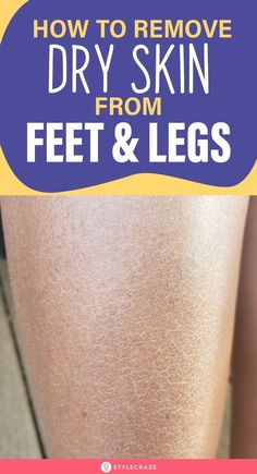 Best Remedies For Face Whitening Dry Skin Legs, Dry Skin Home Remedies, Gel Nail Art Ideas, Cute Nails Black, Dryskin Skincare, Nail Growth Tips, Grow Nails Faster, Fall Nail Inspo, Doctor Help