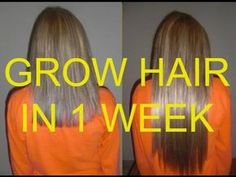 Grow Hair Overnight, Hair Growth Remedy, Growing Long Natural Hair, Longer Hair Faster, Fast Hair Growth