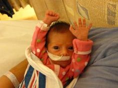 a baby with bandages on its face is sitting in a bed and looking at the camera