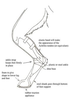 the diagram shows how to use an electric device for foot pain and tendor support