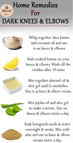 #SelfCare# Home Remedies Remedies For Dark Knees, Dark Knees And Elbows, Dark Knees, Aloe Gel, Homemade Beauty, Fenugreek Seeds, Natural Diy, Almond Oil