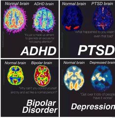 the facebook page shows different types of brain images