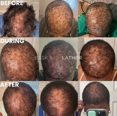 Who else is tracking their progress!? Y’all really need to give your hair a break to breathe! 👏🏾 Manipulating your hair too much can lead to hair loss or thinning. . . . #baskandlather #baskandlatherreviews #growhair #deepconditioner #growhairfast #fasthairgrowth #hairloss #hairlosssolution #hairlosstips #alopecia #naturalhairproducts #naturalhair #hairgrowthproducts #dryscalp #hairgrowthproduct #besthairgrowthoil #quickhairgrowth #hairgrowthjourney #hairgrowthremedies Best Hair Growth Oil, Quick Hair Growth, Hair Remedies For Growth, Hair Growth Faster, Grow Hair Faster, Dry Scalp, Deep Conditioner, Hair A, Grow Hair