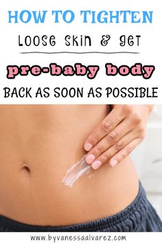 Ultimate Guide to Losing Postpartum Belly Fat - Tighten Loose Skin After Baby Loose Skin After Baby, Lose Postpartum Belly, Belly After Pregnancy, Body Acne Remedies, Tightening Loose Skin, Postpartum Tips, 500 Calories A Day, Post Partum Belly Wrap, Birth Recovery