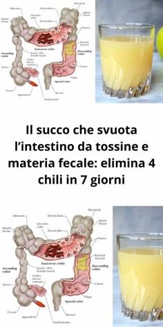 Il succo che svuota l’intestino da tossine e materia fecale: elimina 4 chili in 7 giorni Easy Hair Cuts, Wellness Fitness, Detox Drinks, Weight Watchers Meals, Creative Food, Health Remedies, Healthy Tips