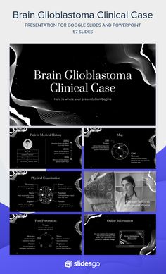 an image of a black and white powerpoint presentation with the title brain globlaatoma clinic case