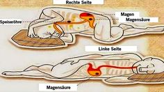 Sleep On Left Side, Gastric Juice, Benefits Of Sleep, Stomach Problems, Sleeping Positions, Acid Reflux, Pranayama, Uttar Pradesh