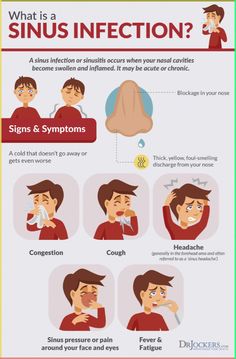 Heres How To Clear Your Sinuses Qu Sinus Infection Remedies, Tips For Good Health, Sinus Headache, Coffee Extract, Sinus Pressure, Sinus Congestion, Sinus Infection, Green Coffee Bean, Workout Chart