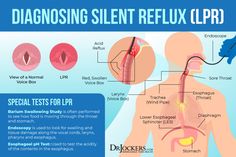 Silent Reflux: Symptoms, Causes, and Support Strategies - Silent Acid Reflux Symptoms, Silent Reflux Symptoms, Silent Reflux Diet, Anti Reflux Diet, Lpr Diet, Acid Reflux Symptoms, Silent Reflux, Getting Rid Of Phlegm