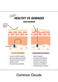 Healthy Skin Barrier, Hormonal Acne Skincare Routine, Hormonal Acne Skincare, Skin Physiology, How To Prevent Blackheads, Skincare Routine Tips, Damaged Skin Barrier, Cosmetics Business, Dry Skincare