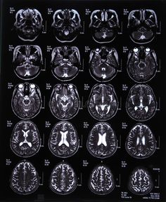 an x - ray image of the human brain showing different areas of the area where it is located