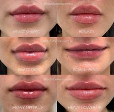 Gaun Koktail, Being Unique, Facial Aesthetics, Lip Filler, Botox Fillers