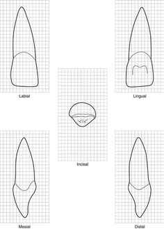 Maxillary Central Incisor Drawing, Dentistry Drawing, Dental Anatomy Drawing, Dental Assistant Study, Small Backyard Garden Design, Dentist Art, Teeth Drawing, Dental Hygiene School, Dentistry Student