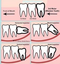 Dental Flashcards, Dental Assistant Study Guide, Dental Charting, Dental Nursing, Dental Assistant School, Dentist Assistant