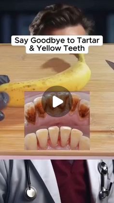 Flat Tummy Tips, Mouth Health, Tartar Removal, Tooth Care, Teeth Whitening Homemade, Teeth Whitener, Teeth Whitening Remedies, Whiten Your Teeth, Body Wellness