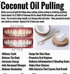 Tantric Yoga, Benefits Of Coconut, Holistic Health Remedies, Coconut Oil Pulling, Teeth Health, Benefits Of Coconut Oil, Oil Pulling, Beauty Tricks, Teeth Care