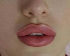 Lips Inspiration, Botox Lips, Facial Aesthetics, Lip Filler, Lip Shapes, Lip Injections, Perfect Lips, Nose Job, Lip Fillers