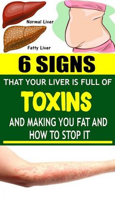 Our liver is one of the most important organs. It helps us eliminate toxins as well as turn them into waste. We eliminate them through feces and urine. We live in a world which is abundant in toxins. Body Organs, Homemade Remedies, Health Challenge, Stop It, Health Diet, Health Lifestyle, Diet And Nutrition, Health Remedies, Body Health