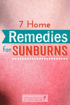 Remedies For Sunburn, Home Remedies For Sunburn, Severe Sunburn, Natural Remedies For Sunburn, Sunburn Remedies