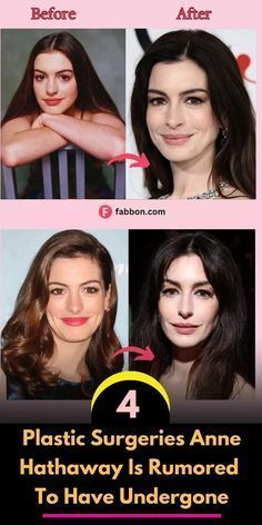 Funny Links, Plastic Surgery Photos, Face Surgery, Celebrity Plastic Surgery