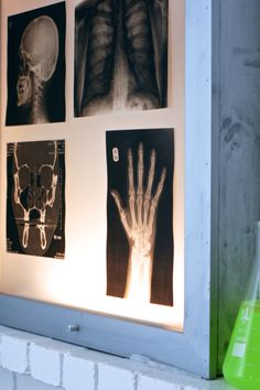 an x - ray image is displayed on the wall next to a green flask