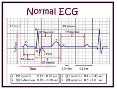 Normal Ecg, Nursing School Studying Cheat Sheets, Emt Study, Cardiology Nursing, Nclex Study, Medicine Notes