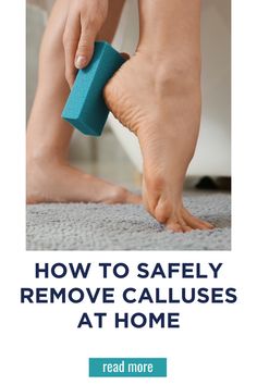 How to Safely Remove Calluses At Home Remove Callous From Foot, How To Remove Callus From Hands, Feet Callus Remover, Remove Dry Skin From Feet Heels, How To Heal Cracked Feet Fast, Soften Heels, Foot Exercises, Callus Removal, Thick Skin