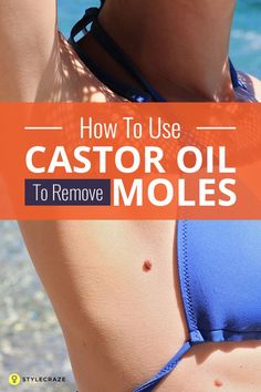 How To Use Castor Oil To Remove Moles Remove Moles, Castor Oil Benefits, Skin Moles, Skin Growths, Mole Removal, Acne Scar Removal, Natural Cough Remedies, Oil Benefits, Oil Uses