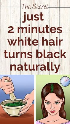 Can white hair turn black again permanently naturally? How to make premature white hair black naturally permanently? How can I permanently cure my white hair? How can I control white hair naturally? Hair Regrowth Tips, Grow Hair Overnight, Reverse Gray Hair, Black And Grey Hair, Coconut Oil Hair Growth, Hair Growth Challenge, Grey Hair Coverage, Hair Care Growth