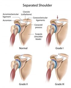 Shoulder Anatomy, Rehab Exercises, Shoulder Rehab, Shoulder Problem, Shoulder Surgery, Shoulder Injuries, Rotator Cuff, Mobility Exercises, Anatomy And Physiology