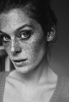 a black and white photo of a woman with freckles on her face looking at the camera