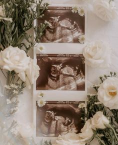 two x - ray images sitting next to white flowers