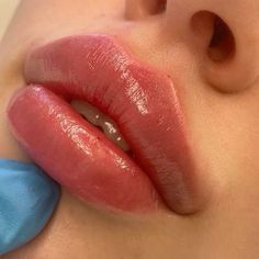 Lips Filler Aesthetic, Pouty Lip Filler, Lip Filler Styles, Lip Filler Shape Ideas, Lip Filler Aesthetic, 1ml Lip Filler, Lip Implants, Russian Lips, Lips Aesthetic