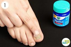 Toenail Fungus Essential Oils, Bad Nails, Toenail Fungus Remedies, Fungal Nail, Peinados Recogidos, French Tip Acrylic Nails, Vicks Vaporub, Toenail Fungus, Nail Strengthener