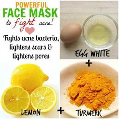 Discover powerful homemade face masks for acne control, cure and prevention. These remedies will help you tackle acne bacteria as well as acne scars, blemishes and large pores. Homemade Face Mask For Acne, How To Stop Pimples, Mask For Acne Prone Skin, Lemon Juice Face, Acne Remedy, Face Mask For Acne, Obličejové Masky, Mask For Acne, Homemade Face Mask