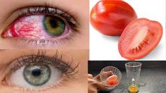 Improve Eyesight Naturally, Whiten Eyes, Eyesight Improvement, Best Eye Drops, To Improve Eyesight, Cucumber And Tomato, Eye Sight