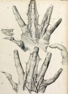 a drawing of a hand with different parts attached to the palm and wrist, from an old book