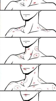 four different stages of neck surgery with red spots on the upper part of the neck